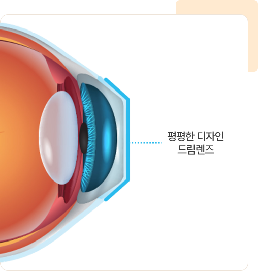 마이사이트 렌즈가 무엇인가요?